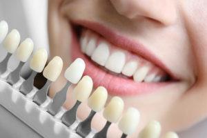 3 Reasons to Choose In-Office Teeth Whitening Services