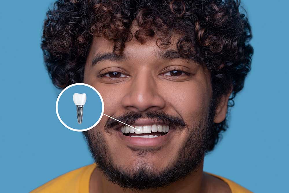 Best practices for caring for dental implants after surgery