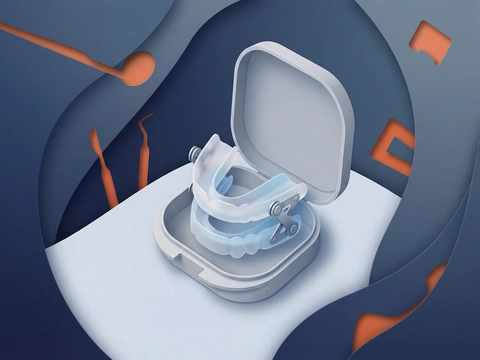 Custom mandibular advancement device for sleep apnea treatment